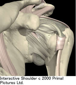 肩関節拘縮では関節包が分厚く、固くなり、正常な運動を妨げます。
