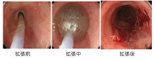 拡張前、拡張中、拡張後