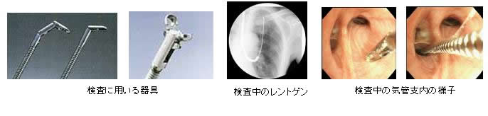 検査に用いる器具/検査中のレントゲン/検査中の気管支内の様子