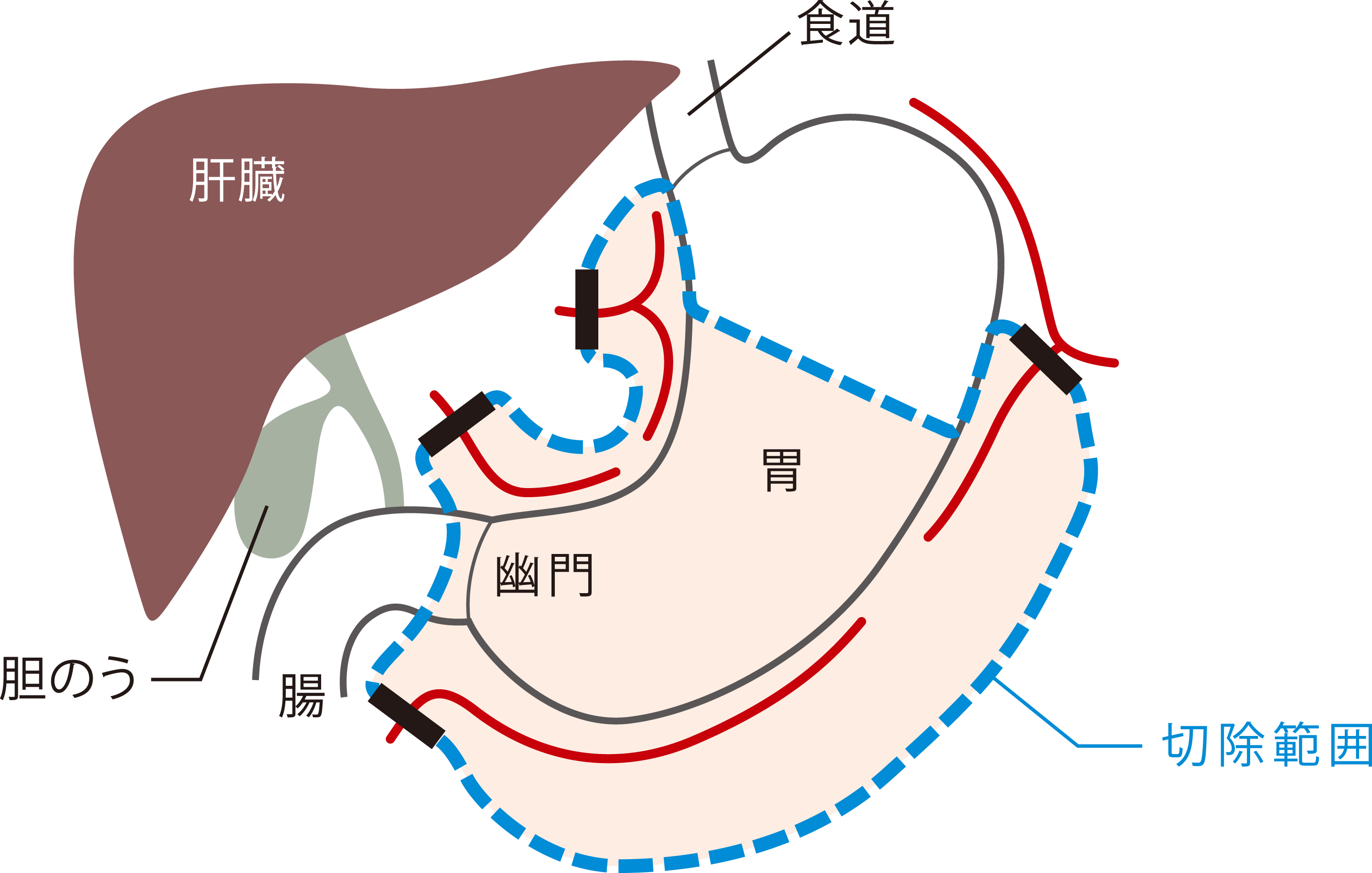 ロボット手術センター手術画像