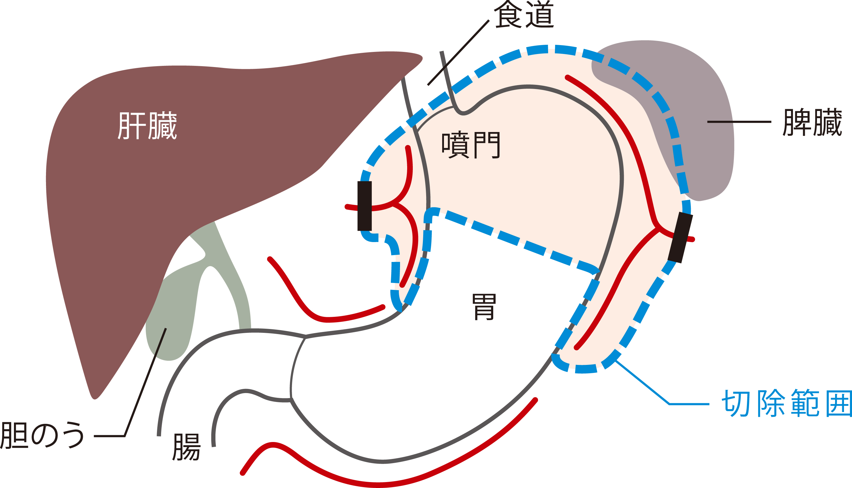 ロボット手術センター手術画像