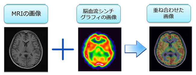 検査の画像