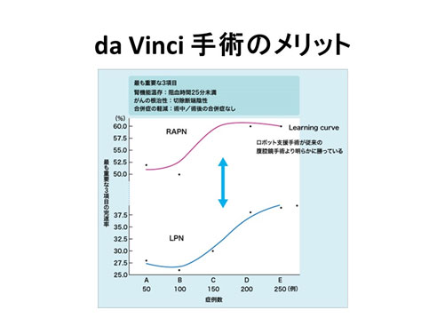 da Vinci手術のメリット