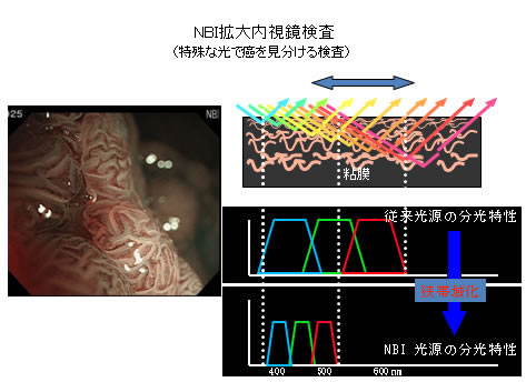 NBI拡大内視鏡検査