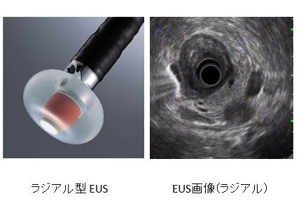 超音波内視鏡検査EUSの様子