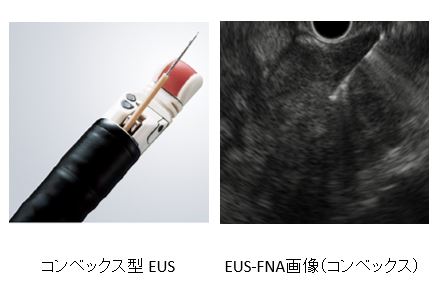 超音波内視鏡下穿刺吸引法EUS-FNAの様子