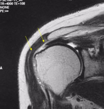 MRI、超音波検査.